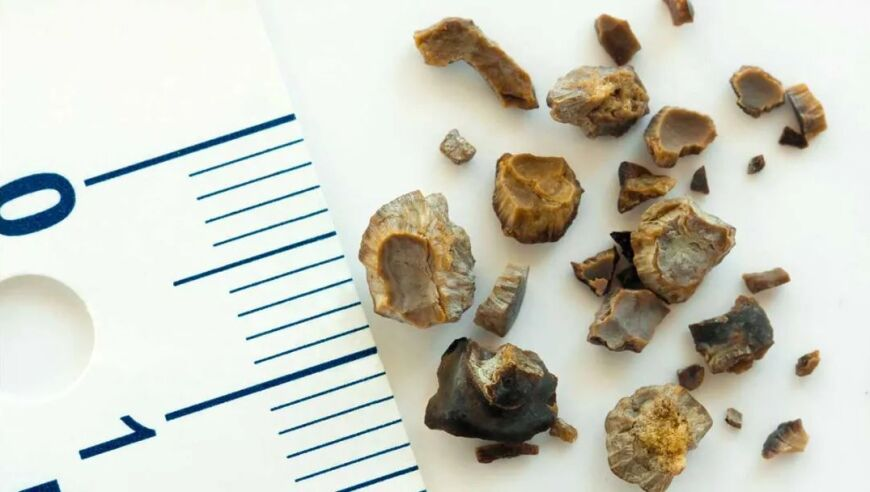 异地恋的情人节,澳门123手机开奖,决策资料解释落实_移动版V1.49